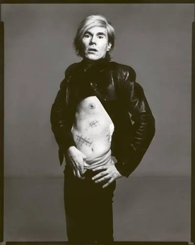Ο Andy Warhol με τις χειρουργικές ουλές από τον πυροβολισμό του 1968